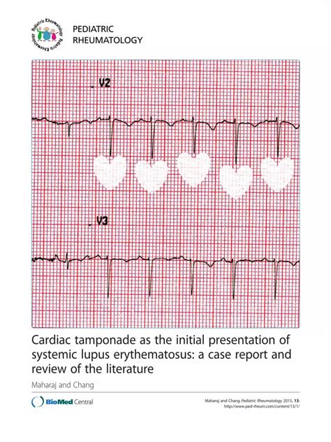 PDF Cardiac Tamponade As The Initial Presentation Of Systemic Lupus