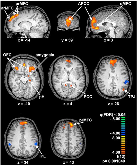 Figure From The Neural Substrates Of Person Comparisonan Fmri Study