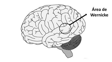 AFASIA DE WERNICKE Qué Es Síntomas Causas Y 47 OFF