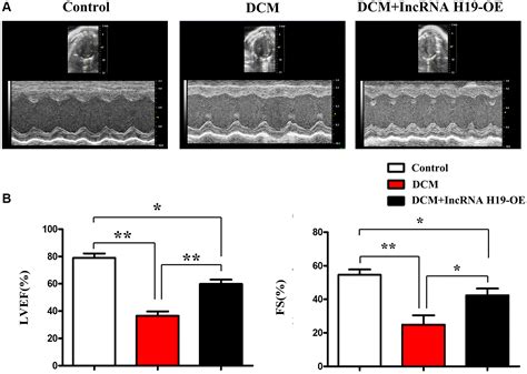 Lncrna H19 Inhibits Er Stress Induced Apoptosis And Improves Diabetic