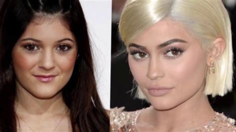 Kylie jenner avant après Before after YouTube