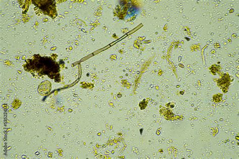 soil microorganism   microscope   agriculture farm stock