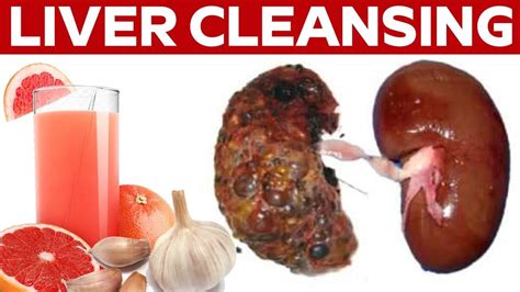 Do Liver Cleanses Work Evidence And Risks Pharmanewsonline