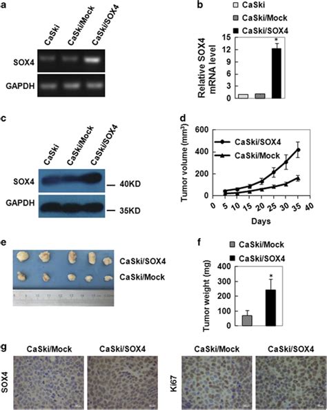 Sox Overexpression Promotes Tumor Growth In Vivo Rt Pcr A Qrt Pcr