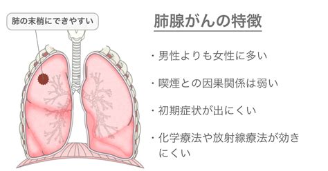 医師監修・作成 肺がんでステージと同じくらい大事な「組織型」：腺がん、扁平上皮がん、大細胞がん、小細胞がん Medleyメドレー