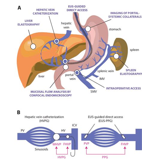 Direct And Indirect Methods For The Assessment Of Portal Hypertension