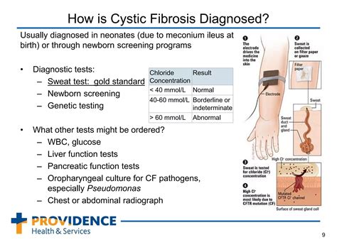 Cystic Fibrosis Student Version Ppt