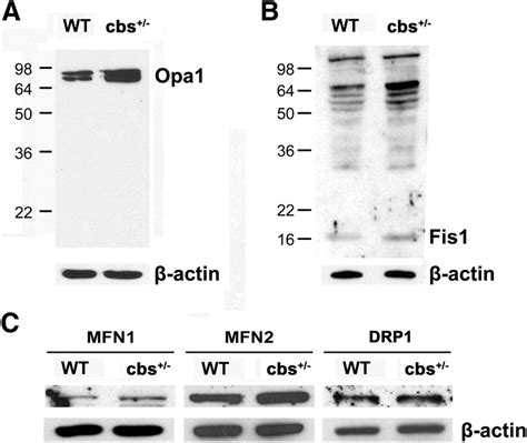 Opa1 And Fis1 Protein Levels Are Increased In Neural Retinas Of Cbs