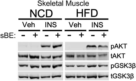 Exposure To Static Magnetic And Electric Fields Treats Type 2 Diabetes