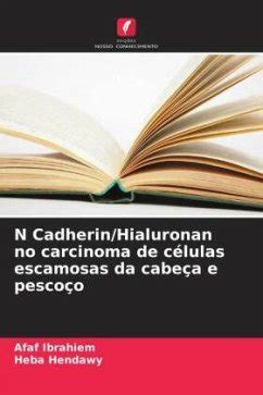 N Cadherin Hialuronan no carcinoma de células escamosas da cabeça e