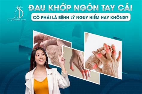 Đau Khớp Ngón Tay Cái Có Phải Là Bệnh Lý Nguy Hiểm Hay Không