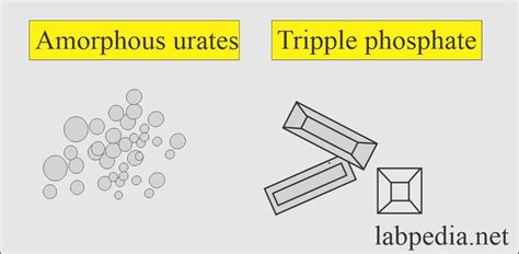 Amorphous Urates Vs Amorphous Phosphates