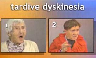 Tardive Dyskinesia Definition, Treatment, Symptoms, Causes