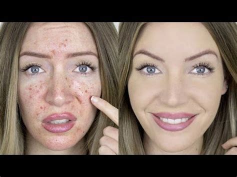 Full Coverage Acne Foundation Routine Skincare STEPHANIE LANGE