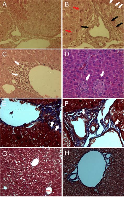 Histopathological Analysis Of Pathological Changes In The Liver Of