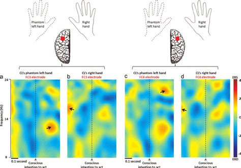 Spectral Power In The Mu And Beta Bands Around The Time Of Conscious