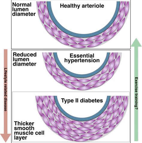 Structural alterations of smaller arterioles in skeletal muscle in ...