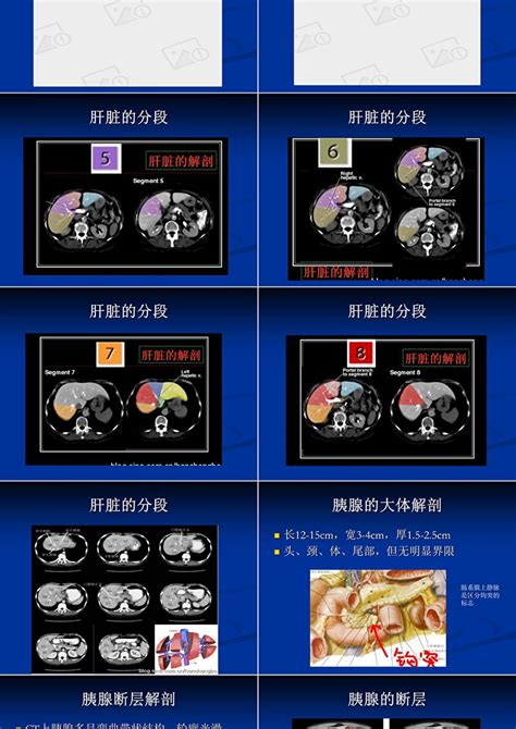 腹部ct 断层解剖结构肝、胰腺ppt模板卡卡办公