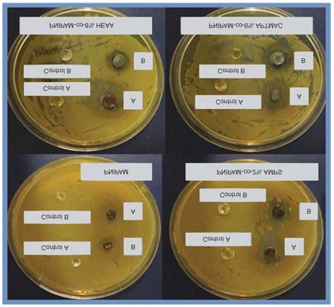 Photographs Of Bacterial Grown Of Pseudomonas Aeruginosa After 48 H Download Scientific Diagram