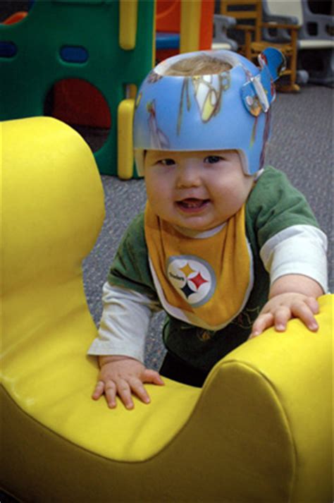 Flat Head Syndrome Helmets | POPSUGAR Moms