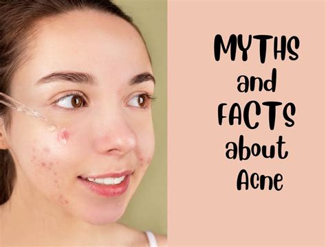 Get Over Acne Myths Here Are 10 Myths And Facts About Adult Acne