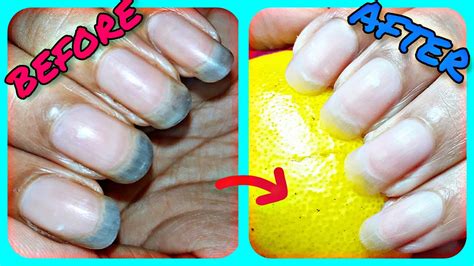 How Can I Keep My Nails Clean And Shiny YouTube