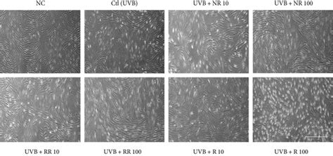 Normal Human Dermal Fibroblast Nhdf A Cell Morphology And B Cell