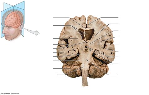 Coronal Section Of Brain Diagram Quizlet