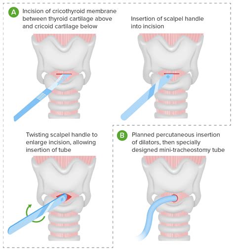 Basic Procedures Concise Medical Knowledge