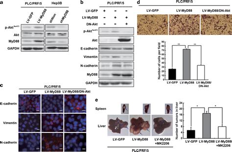 Myd88 Activates Akt Promoting Metastatic Potential Of Hcc Cells A