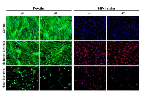 Immunohistochemical Validation Of Hypoxia Under Ischemia Mimicking