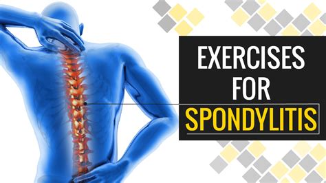 5 Minute Exercise to Get Rid of Spondylosis and Neck Pain | Truweight ...