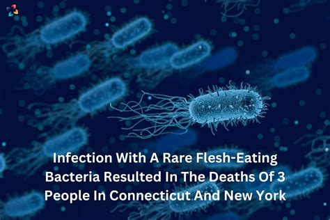 A Rare Flesh Eating Bacteria Resulted In The Deaths Of 3 People The