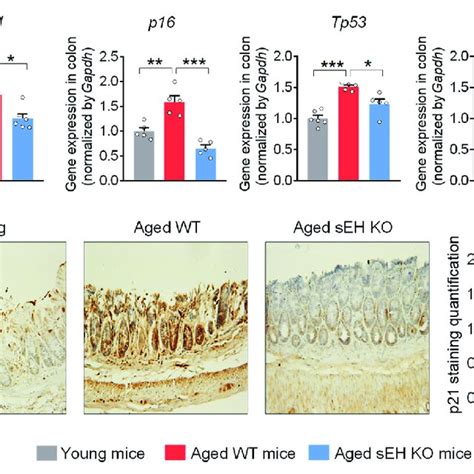 Seh Deficiency Attenuates The Cell Senescent Markers In The Colon Of