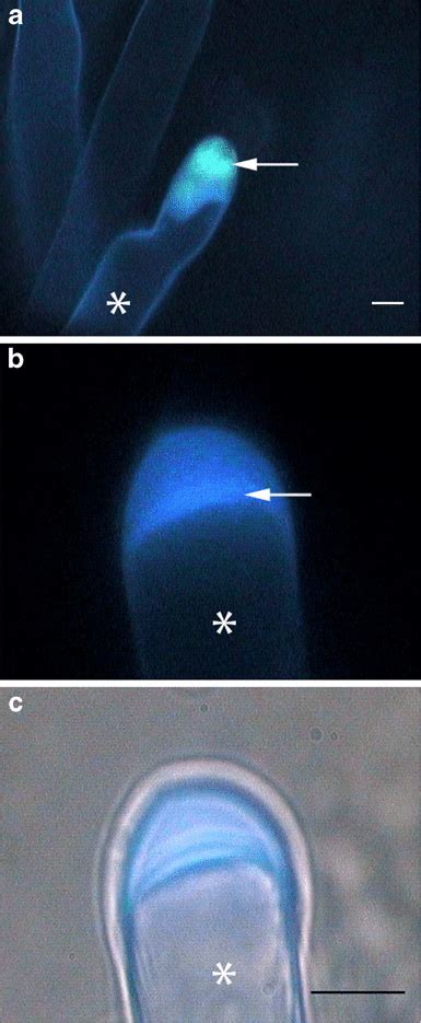 a-c Root hair tips under the fluorescence microscope. a-c Cell wall... | Download Scientific Diagram