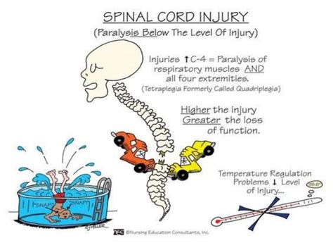 Spinal cord injury clipart - Clipground