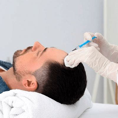 PRP Hair Treatment In Dubai PRP Cost PRP Treatment