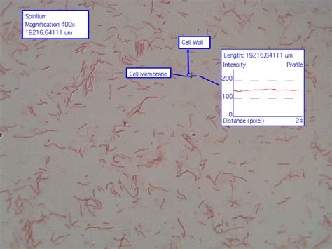 Kingdom Eubacteria - 6 Kingdoms of Life