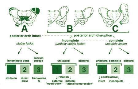 Fractura De Pelvis Diagrama