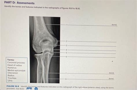 Solved Part D Assessments Identify The Bones And Features Chegg