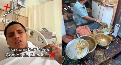 Tiktok Viral Peruano Termina En El Hospital Tras Probar Comida