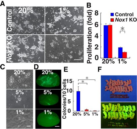 An Interplay Of Nox1 Derived Ros And Oxygen Determines The Spermatogonial Stem Cell Self Renewal