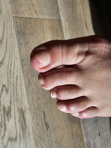 Gallery 1 — Saanich Happy Feet