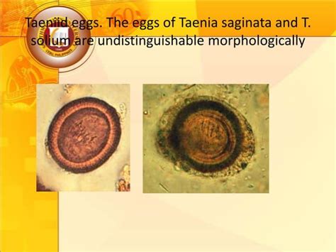 Cestodes Ppt