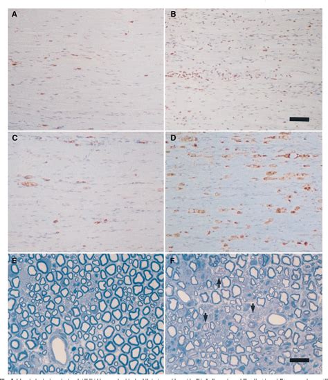 Figure From The Role Of The Very Late Antigen And Its Counterligand