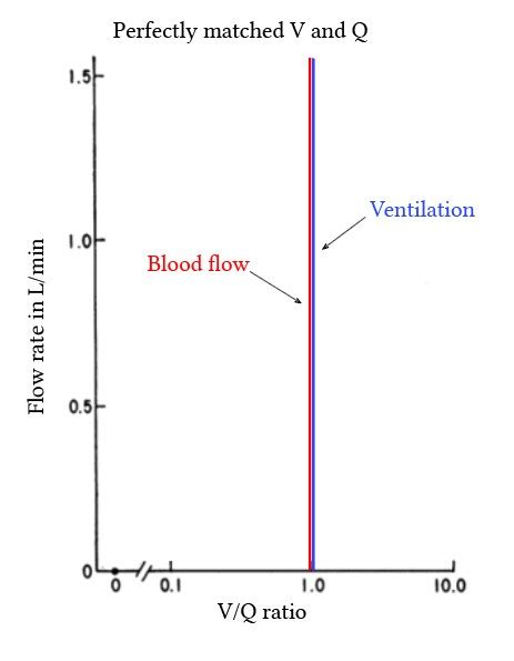 Ventilation Perfusion Matching And Mismatching Deranged Physiology