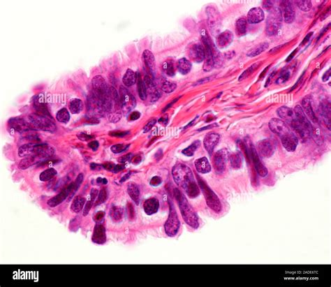 Simple Columnar Ciliated Epithelium Fallopian Tube