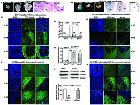 Effects Of Sb In Bladder Smooth Muscle Cell Differentiation A