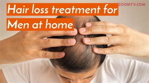 Hair Loss Treatment For Men At Home Grooming Tips Youtube