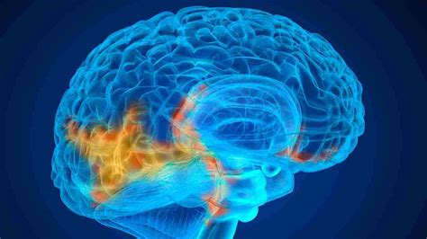 An Overview Of Glioblastoma Multiforme